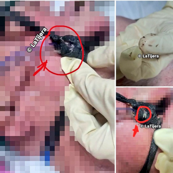 el horror del sistema de salud castrista que nadie quiere ver
