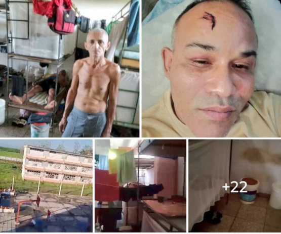 Denuncian torturas y esclavitud en prisioneros de Veguita: ¡La verdad oculta de Cuba que impacta al mundo!