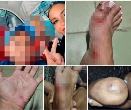 Un atropello en Playa deja a madre e hijo heridos y el responsable se da a la fuga, ¡tu ayuda es crucial!