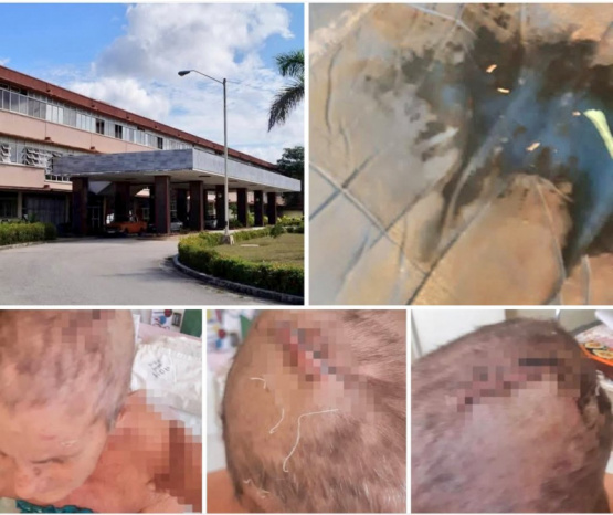 ¡La salud pública de Holguín en crisis! Descubre la terrible denuncia que sacude al sistema hospitalario cubano.