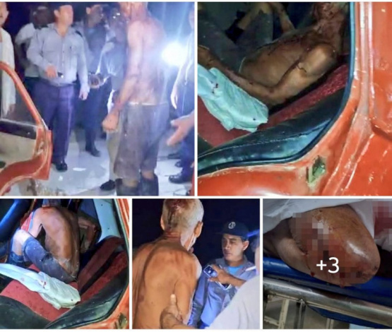 Un campesino clama por justicia tras un violento robo en Contramaestre: ¡la corrupción judicial libera a los delincuentes! ¿Hasta cuándo habrá impunidad en Cuba?
