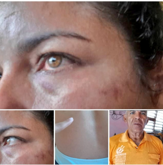 Denuncia desgarradora desde Cuba: Daylin León Alarcón revela el brutal maltrato de su padre, ¿las autoridades harán algo al respecto?